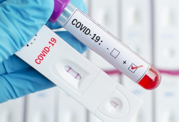 24% от направените тестове за изминалото денонощие са положителни